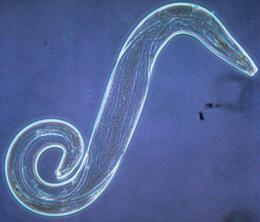 Bakteri Tanah Bacillus thuringiensis dapat Menghasilkan Obat untuk Cacing Perut